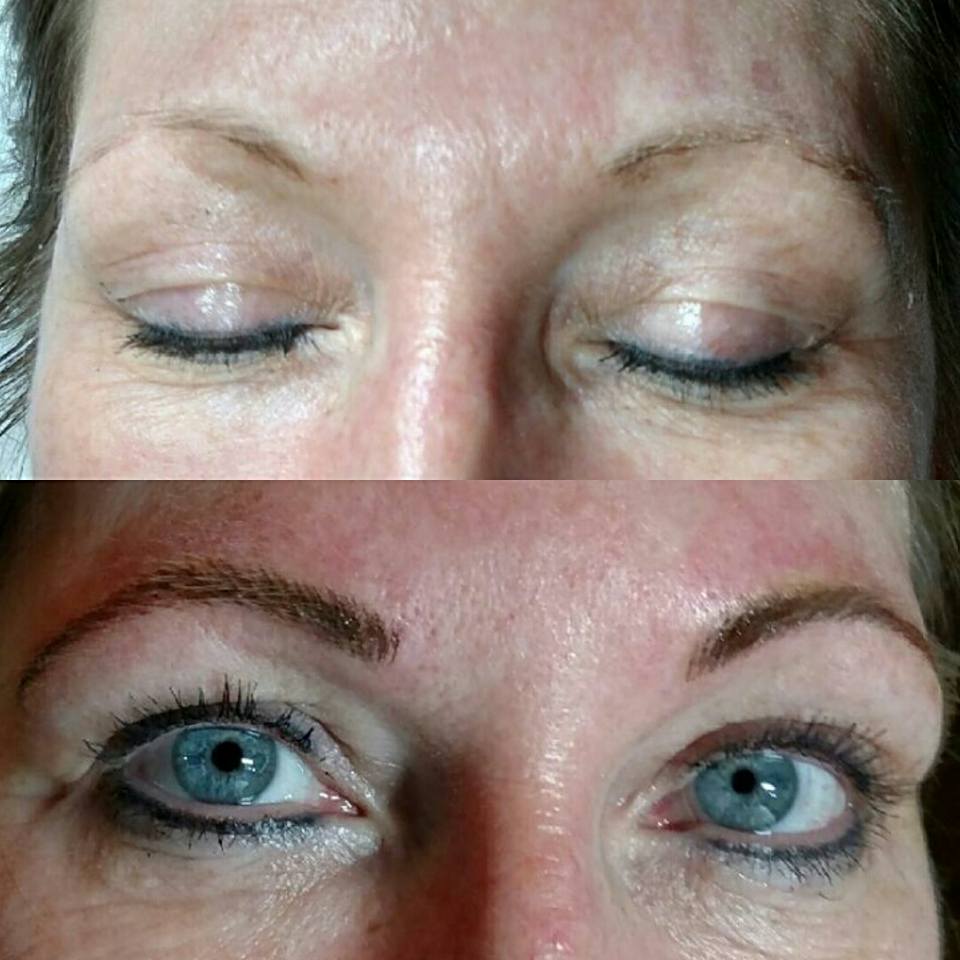 Before and Aftere