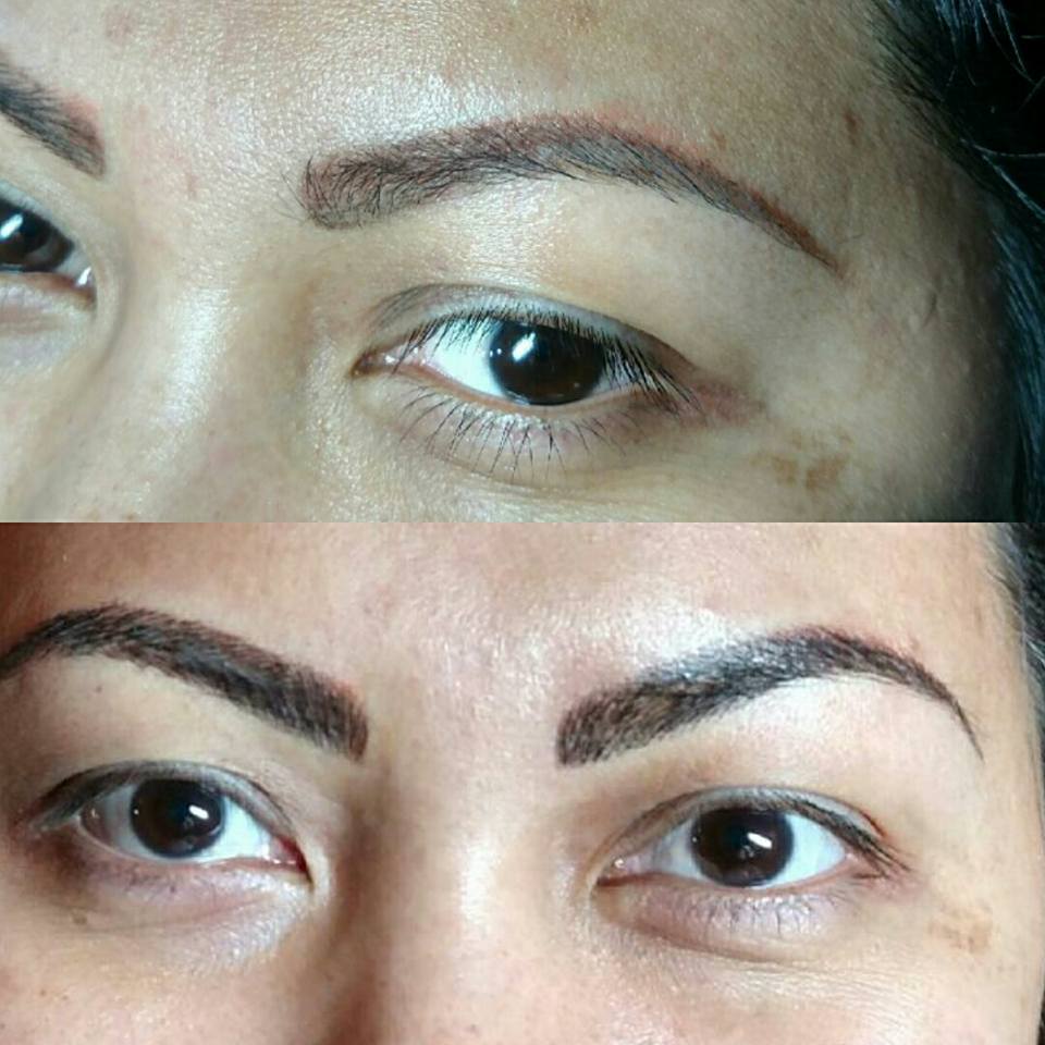 Before and Aftere