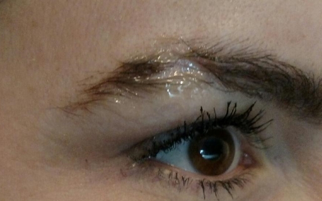 Scar before